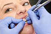 Orthodontist tightening braces