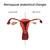 Menopause anatomical changes, illustration