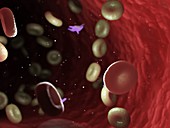 Diseased blood cells, illustration
