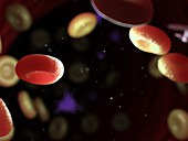 Diseased blood cells, illustration