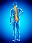 Back pain, conceptual illustration