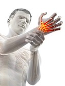 Wrist pain, conceptual illustration