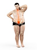 Obese man with back pain, illustration