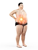 Obese man with back pain, illustration