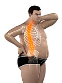 Obese man with back pain, illustration