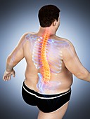 Obese man with back pain, illustration