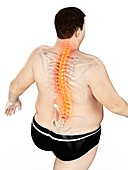 Obese man with back pain, illustration