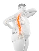 Obese man with back pain, illustration