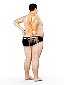 Obese man with back pain, illustration