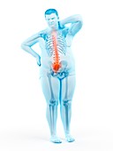 Obese man with back pain, illustration