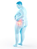 Obese man with hip pain, illustration