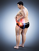 Obese man with hip pain, illustration