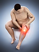 Obese man with knee pain, illustration