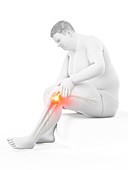 Obese man with knee pain, illustration