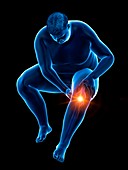 Obese man with knee pain, illustration