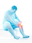 Obese man with knee pain, illustration
