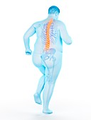 Obese runner with back pain, illustration