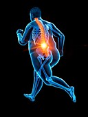 Obese runner with back pain, illustration