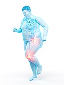 Obese runner with joint pain, illustration