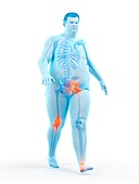 Obese runner with joint pain, illustration