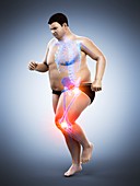 Obese runner with joint pain, illustration