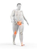 Obese runner with joint pain, illustration