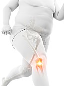 Obese runner with knee pain, illustration