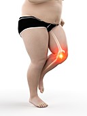 Obese runner with knee pain, illustration