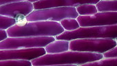 Plant cell plasmolysis, light microscopy