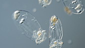 Asplanchna rotifers, light microscopy