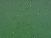 Legionella bacteria