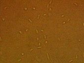Legionella bacteria
