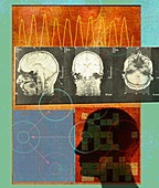 Brain waves and MRI scan of man's head, illustration