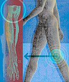 Man walking with target over knee, illustration