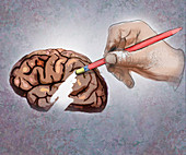 Dementia, conceptual illustration