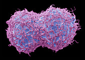 Dividing breast cancer cells, SEM