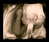 Foetus at 21 weeks, 3D ultrasound scan