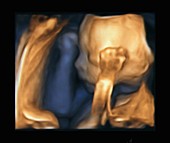 Foetus at 21 weeks, 3D ultrasound scan