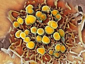 Gonorrhoea bacteria, SEM