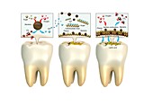 Formation of plaque on teeth, illustration