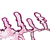 Ciliary body, light micrograph