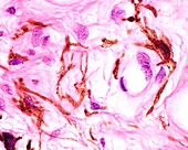 Melanocytes in iris stroma, light micrograph