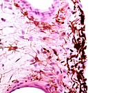 Anterior surface of iris, light micrograph