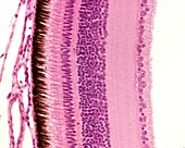 Layers of the retina, light micrograph
