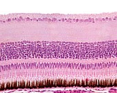 Layers of the retina, light micrograph