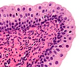Urinary bladder transitional epithelium, light micrograph