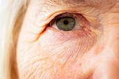 Senior woman's eye