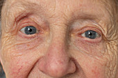 Senior woman's eyes