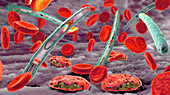 Malaria infection, illustration