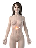 Pancreatic cancer, conceptual computer illustration